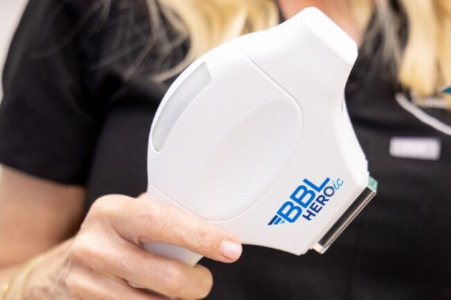 Is BBL Laser Hair Removal Worth The Money