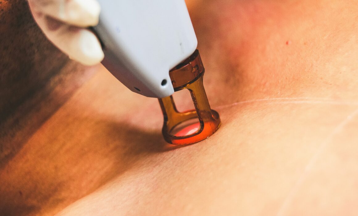 BareHR laser hair removal treatment for smooth skin at The Fitz Aesthetics in Edmond OK